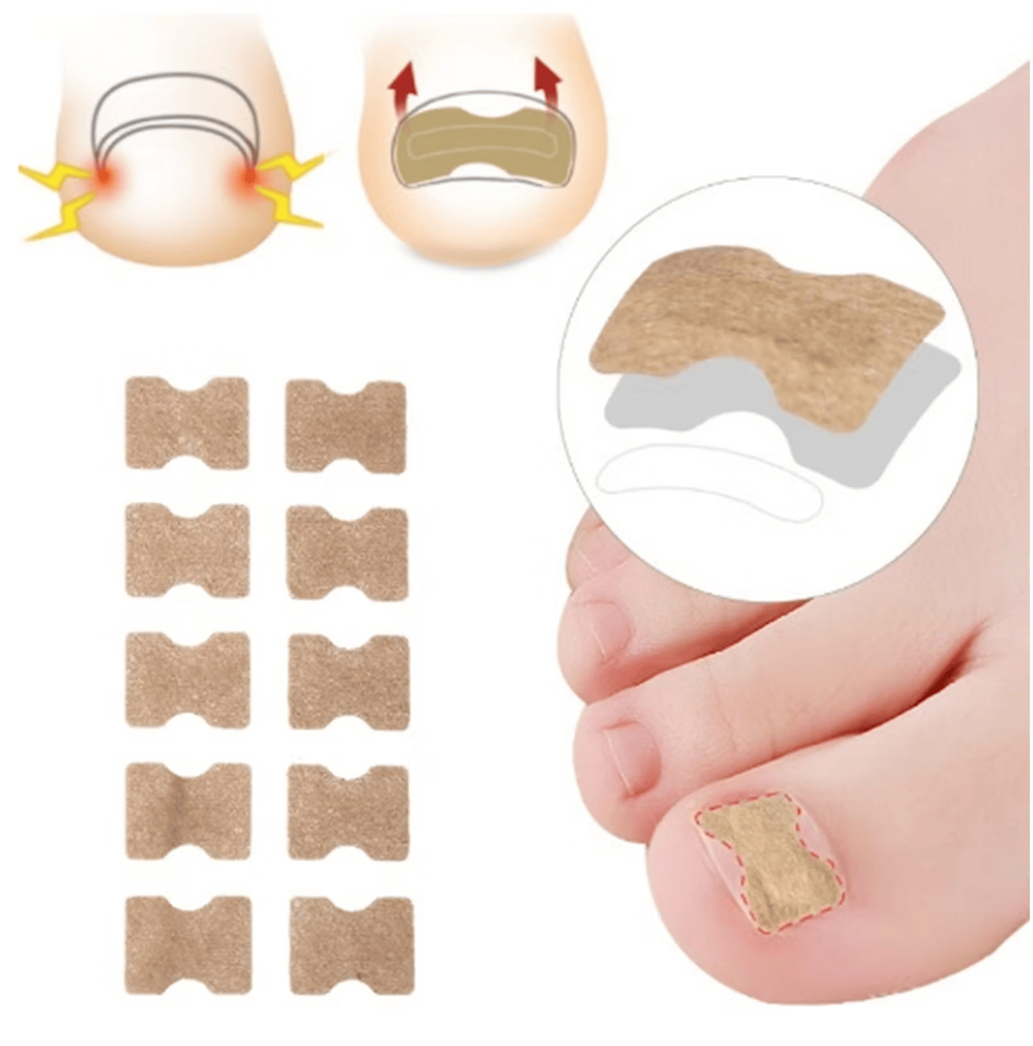 Plåster mot nageltrång för skonsam korrigering