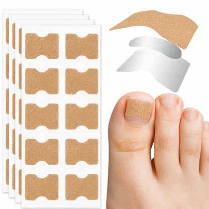 Nageltrångskorrigeringstejp applicerad på stortån för att hjälpa till att avlasta nagelkanterna och minska irritation och obehag vid nageltrång.