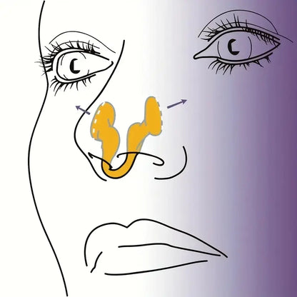 Illustration som visar hur silikon-näsklämma placeras i näsan för att öppna luftvägarna