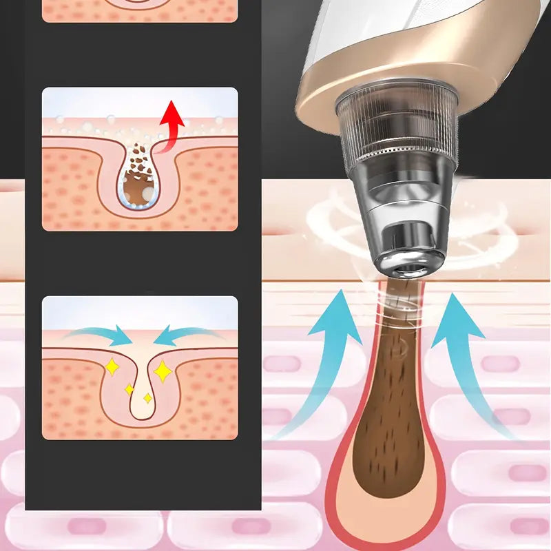 Illustration som visar hur en elektrisk pormaskborttagare suger upp smuts och talg ur porerna