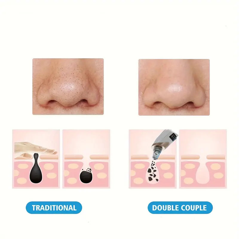 Illustration som visar före och efter rengöring av porer samt hur en pormaskborttagare avlägsnar smuts ur huden